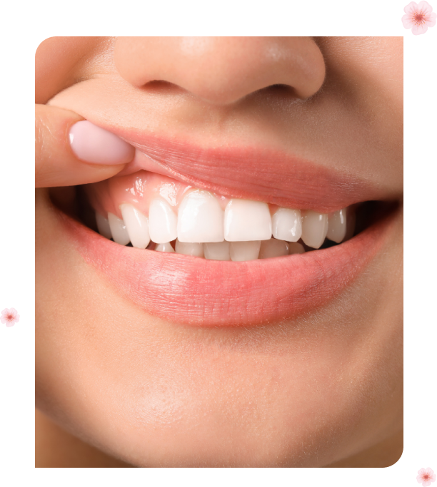 Preventative Dentistry Services Cherry Blossom Dentistry