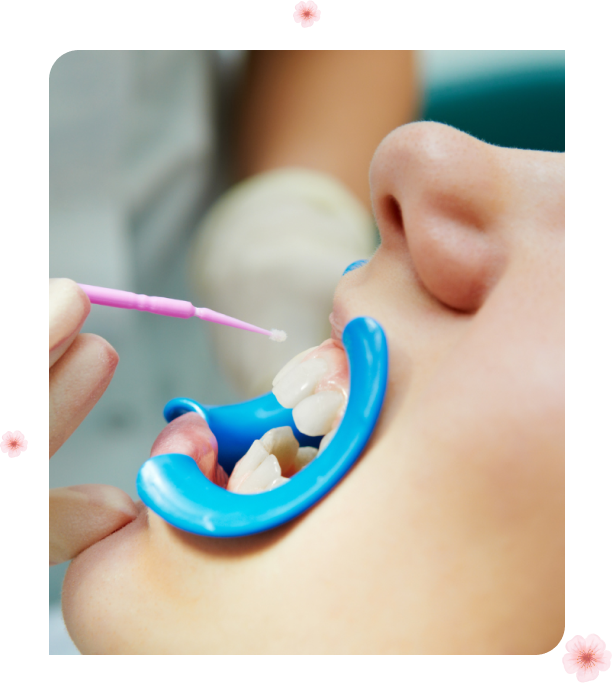 Preventative Dentistry Services Cherry Blossom Dentistry